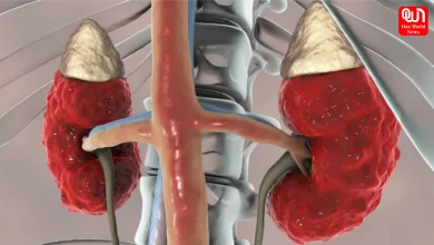 Kidney Disease Risk