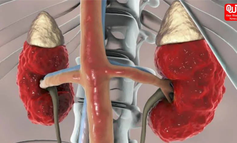 Kidney Disease Risk