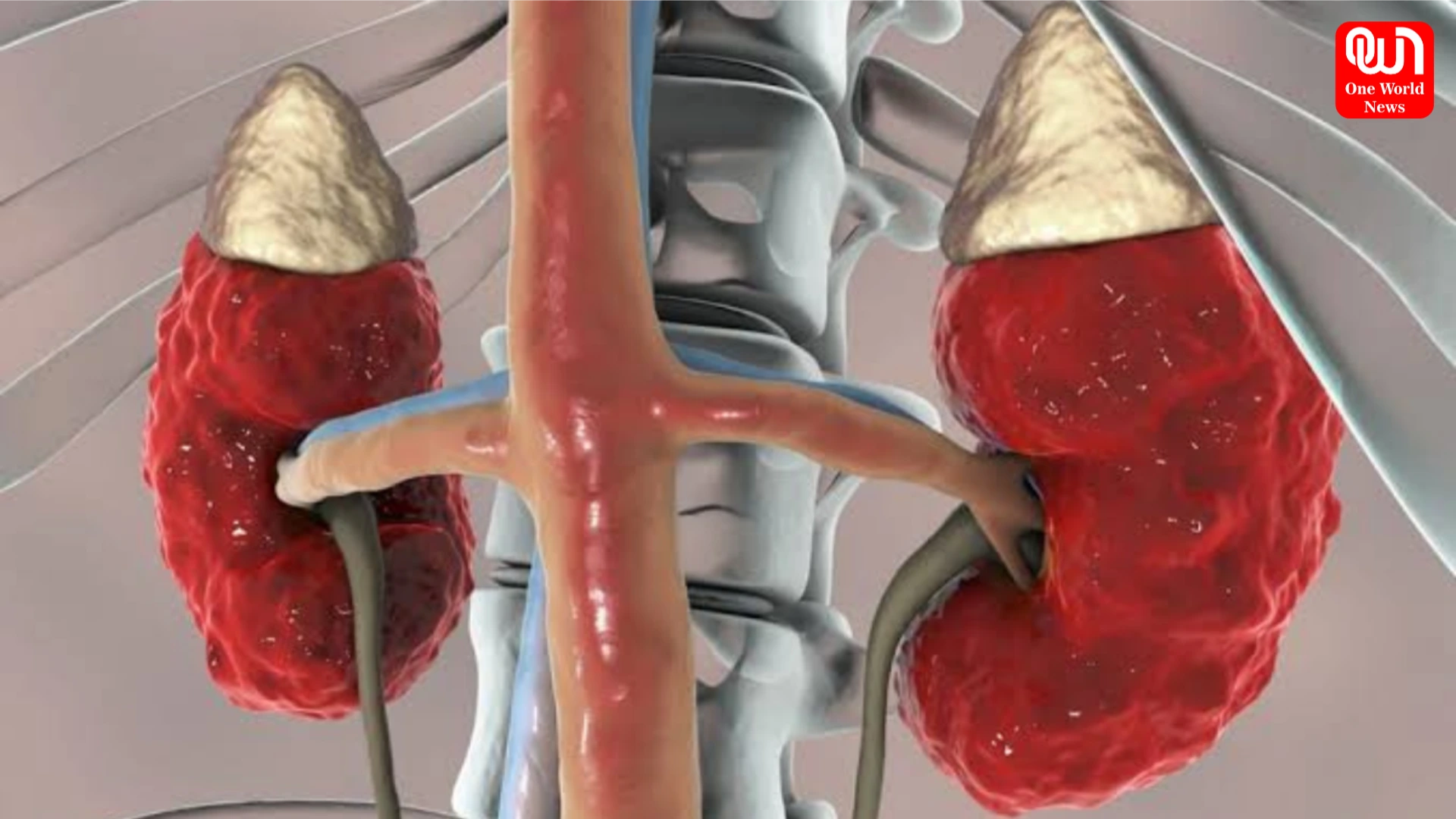 Kidney Disease Risk