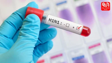 Swine Flu