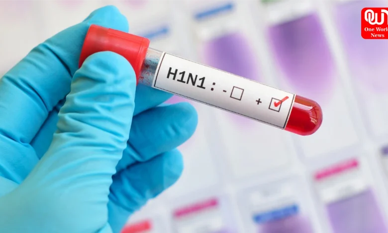 Swine Flu